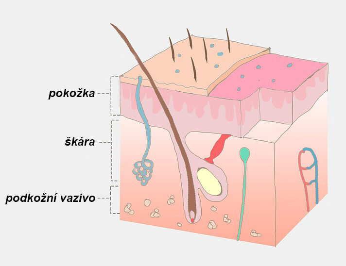 Škára