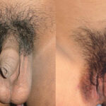 Pubic_hair_male-female