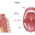 hltan