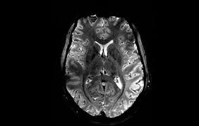 MRI, ultrazvuk – video