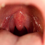human throat in centre with tongue