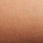 Texture of human skin closeup with small defects
