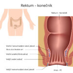 rektum-konecnik