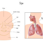 Šíje sije
