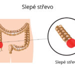 slepe-strevo