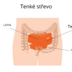 tenke-strevo