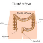 tluste-strevo