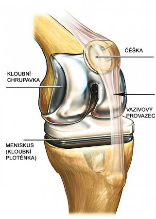 Čéška