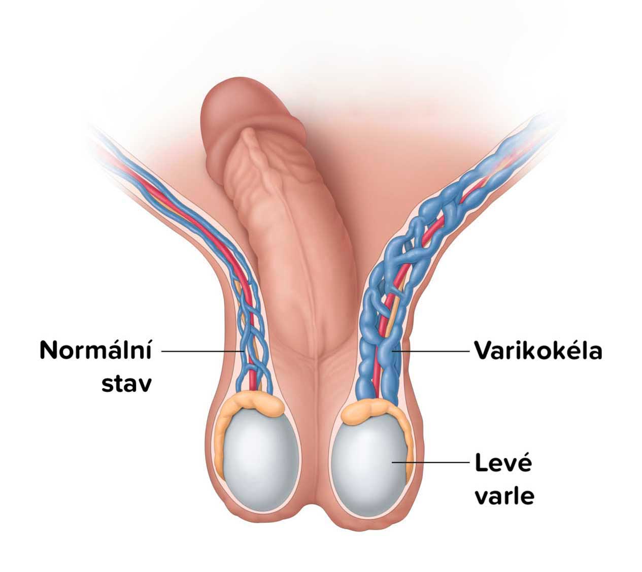 Varle