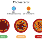 5454-cholesterol