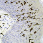 Dendritic_cells