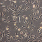 Endothelial_cells