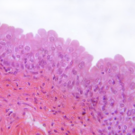 Harnblase_Urothel