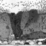Lung_epithelium_80294-2.6