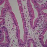 Microvilli-Duodenum
