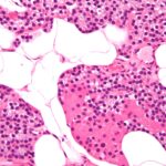 Parathyroid_gland_high_mag