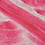 Skeletal_muscle_-_longitudinal_section