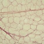 Yellow_adipose_tissue_in_paraffin_section_-_lipids_washed_out