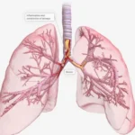 depositphotos_661690750-stock-photo-inflammation-constriction-airways-rendering