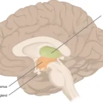 iencephalon.jpg