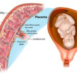 placenta-1