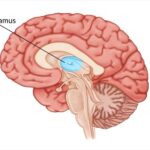 thalamus-damage