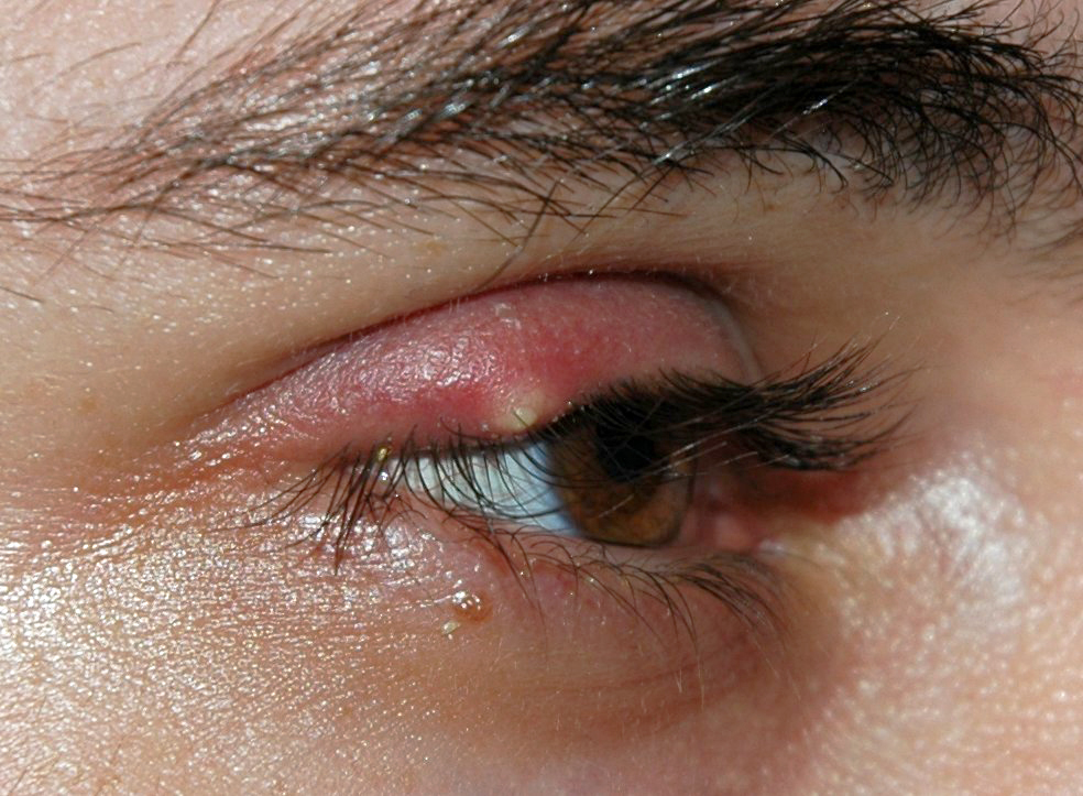 Ječné zrno