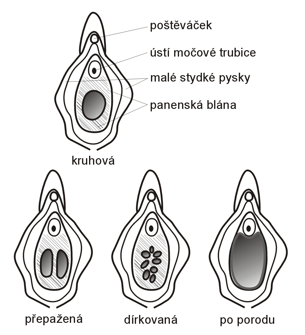 Typy panenských blan