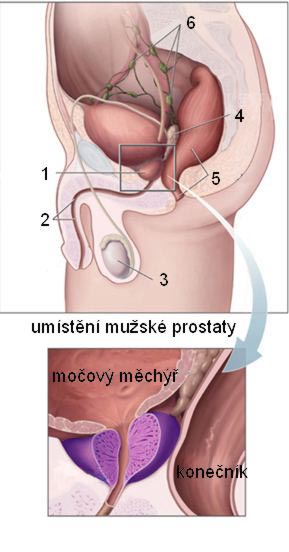 Umístění prostaty: 1. prostata, 2. močová trubice, 3. varle, 4. semenný váček, 5. konečník, 6. mízní uzliny