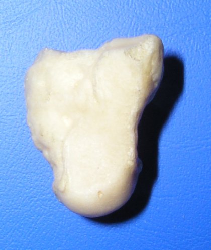 Os capitatum levé ruky, pohled na palmární stranu
