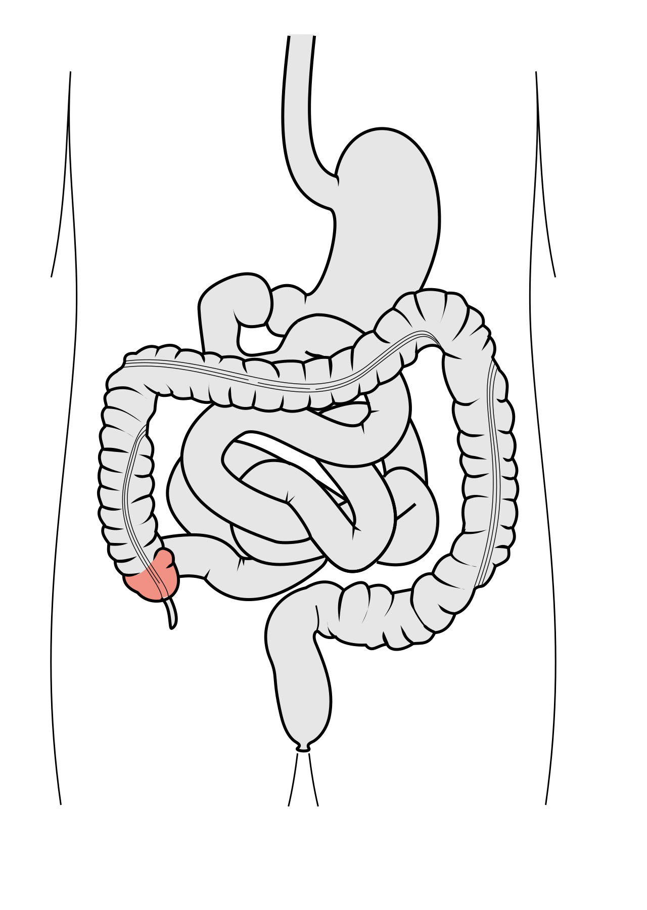Schematický diagram gastrointektinálního traktu; slepé střevo znázorněno růžově