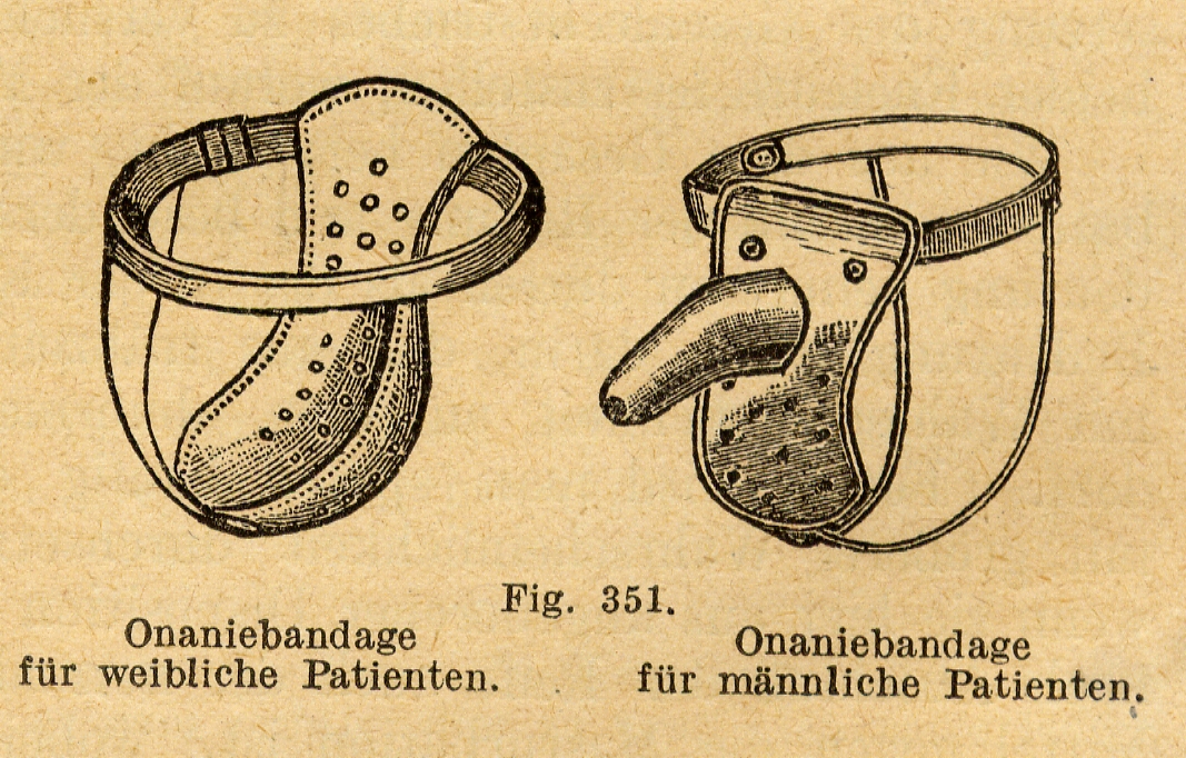 Protimasturbační pásy Alberta Molla, 1926.